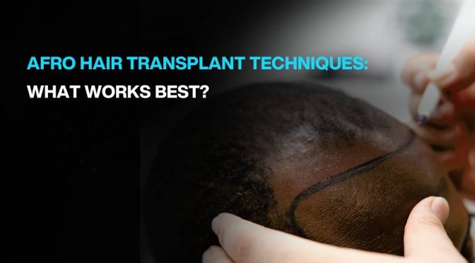 afro hair transplant techniques