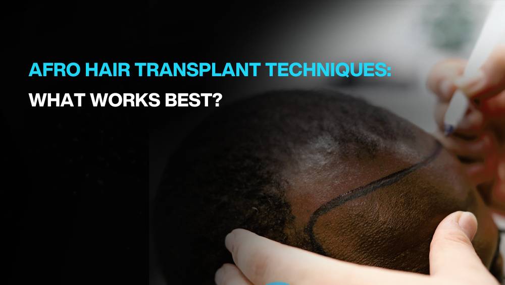 afro hair transplant techniques