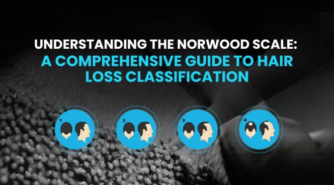 norwood scale