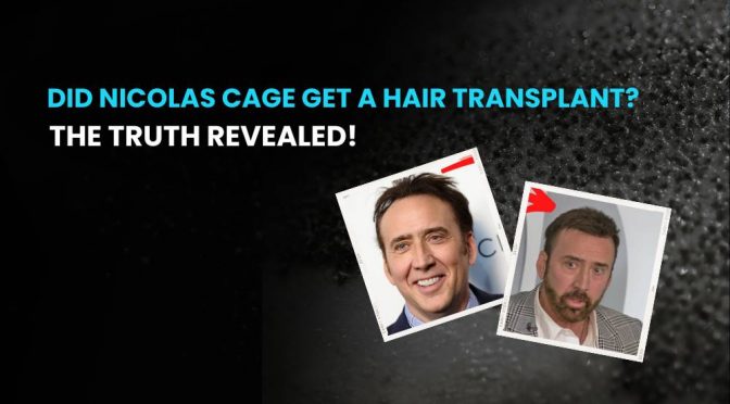 Did Nicolas Cage Get a Hair Transplant The Truth Revealed