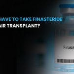 Do you have to take finasteride after hair transplant