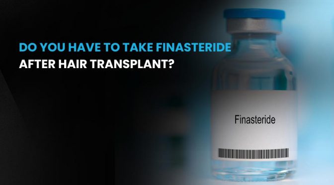 Do you have to take finasteride after hair transplant