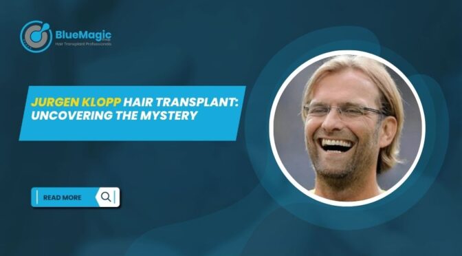 Jurgen Klopp Hair Transplant Uncovering the Mystery