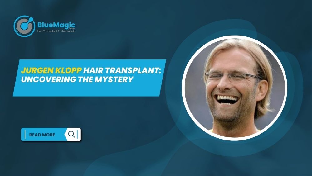 Jurgen Klopp Hair Transplant Uncovering the Mystery