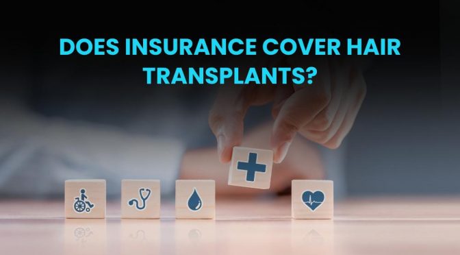 does insurance cover hair transplants
