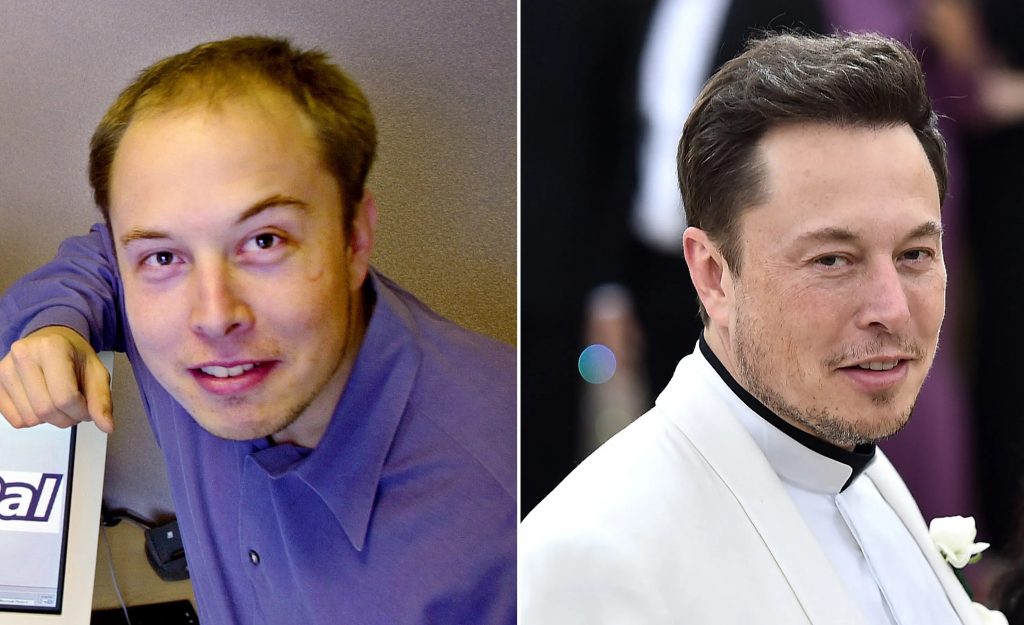 elon musk before and after