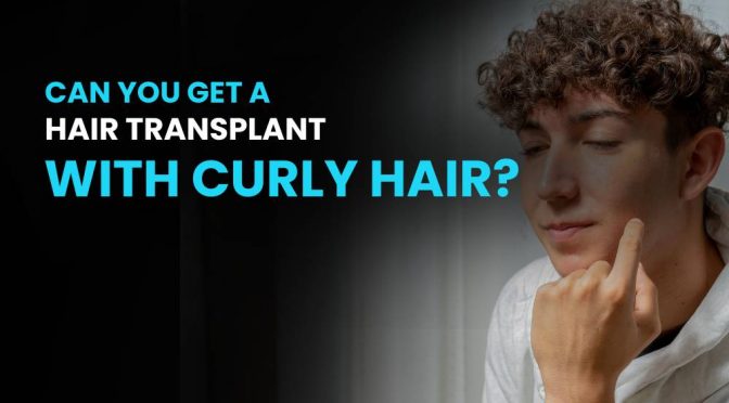 Can You Get a Hair Transplant with Curly Hair
