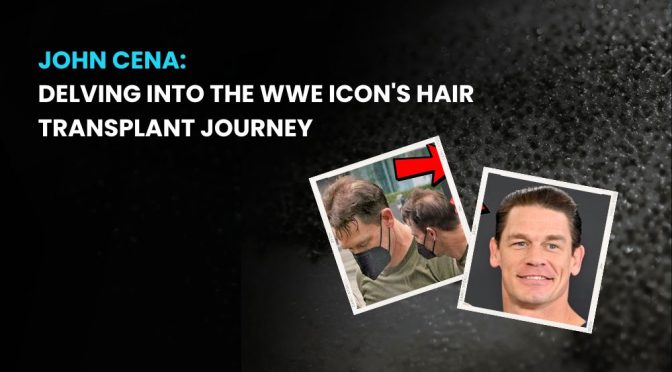 John Cena Hair Transplant Journey