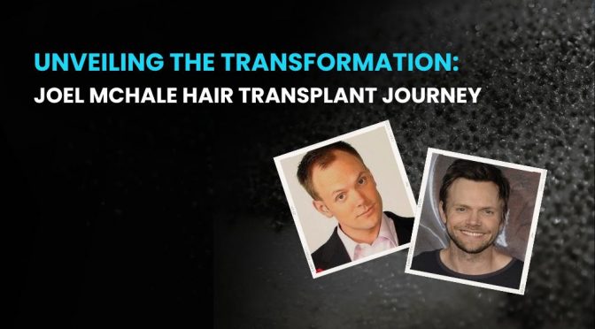 Joel McHale Hair Transplant Journey 