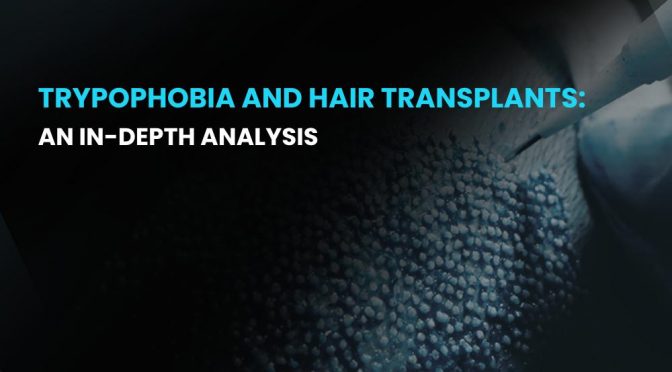Trypophobia and Hair Transplants 