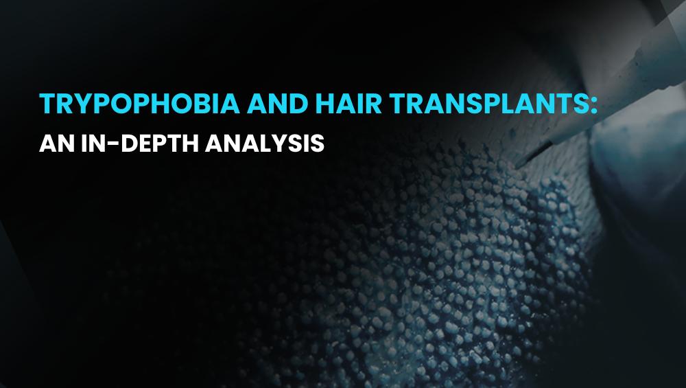 Trypophobia and Hair Transplants