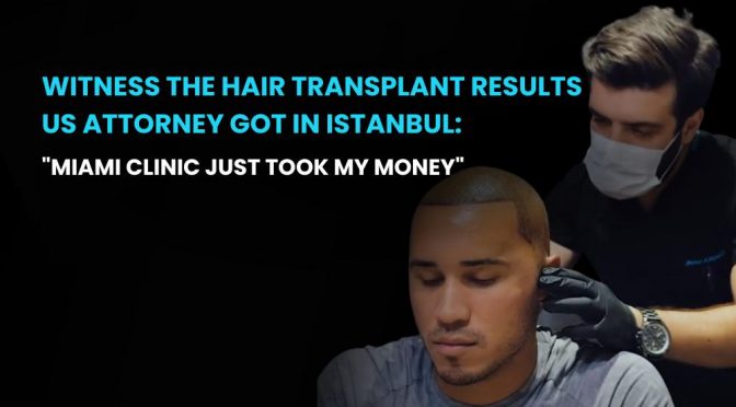 Witness the hair transplant results US Attorney got in Istanbul 