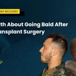 The Truth About Going Bald After Hair Transplant Surgery