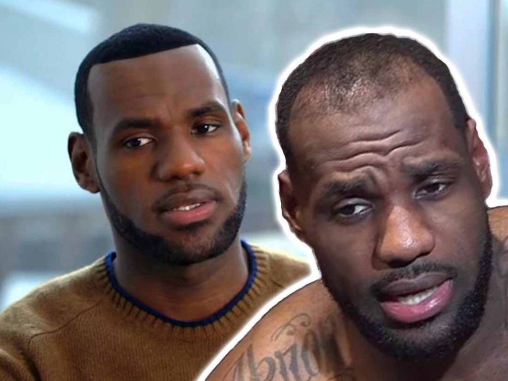 lebron james hair transplant before and after images