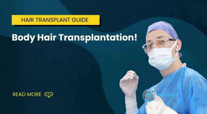 Body Hair Transplantation! A Comprehensive Guide