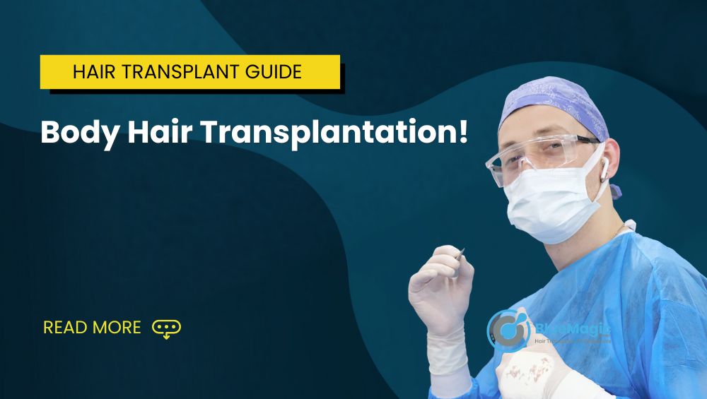 Body Hair Transplantation
