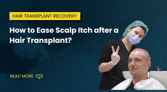 How to Ease Scalp Itch after a Hair Transplant
