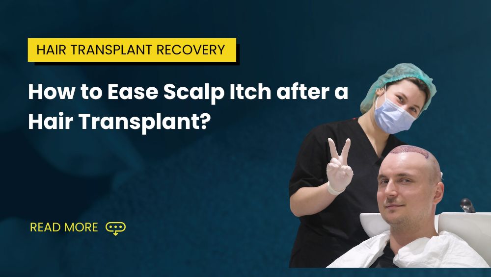 How to Ease Scalp Itch after a Hair Transplant