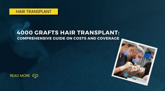 4000 Grafts Hair Transplant: Comprehensive Guide on Costs and Coverage