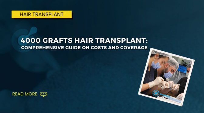 4000 Grafts Hair Transplant