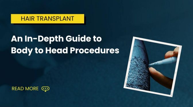 An In Depth Guide to Body to Head Procedures