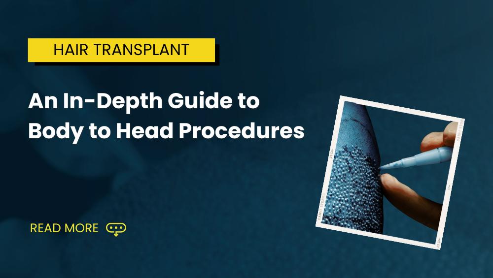 An In Depth Guide to Body to Head Procedures