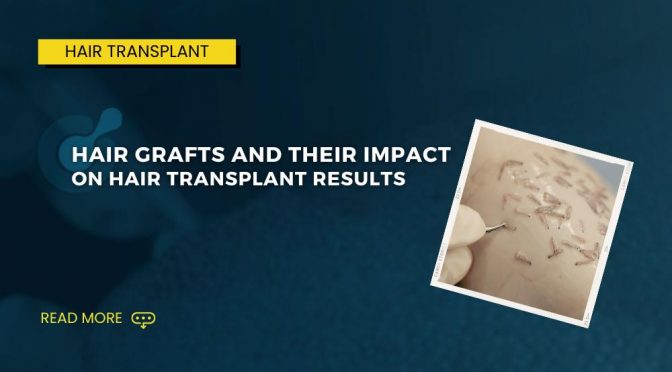 Hair Grafts and Their Impact on Hair Transplant Results 1