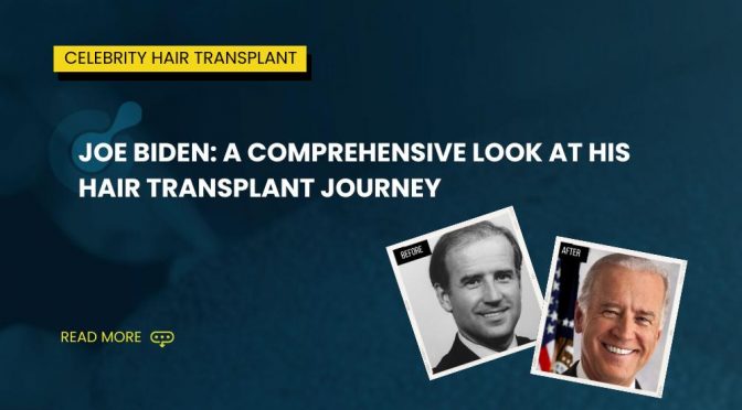 Joe Biden: A Comprehensive Look at His Hair Transplant Journey