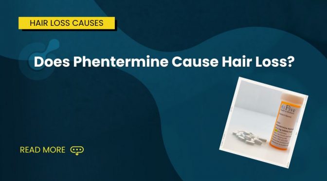 Does Phentermine Cause Hair Loss
