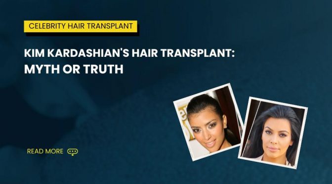 Kim Kardashians Hair Transplant