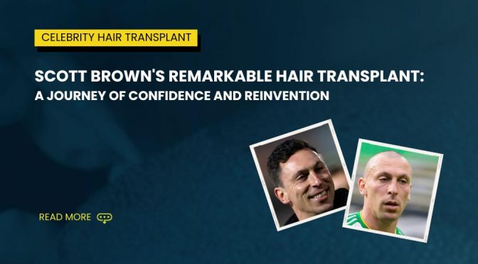 Scott Brown’s Remarkable Hair Transplant: A Journey of Confidence and Reinvention