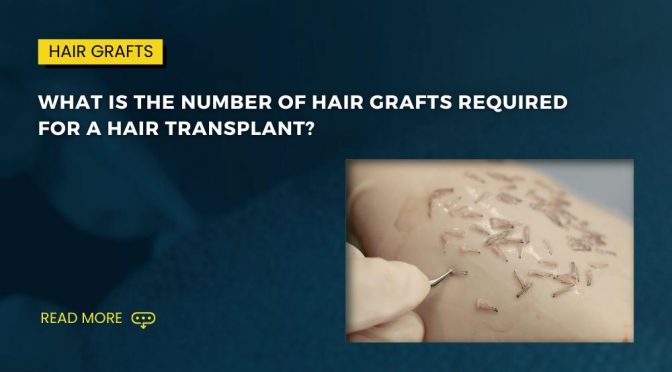 What is the number of hair grafts required for a hair transplant 1