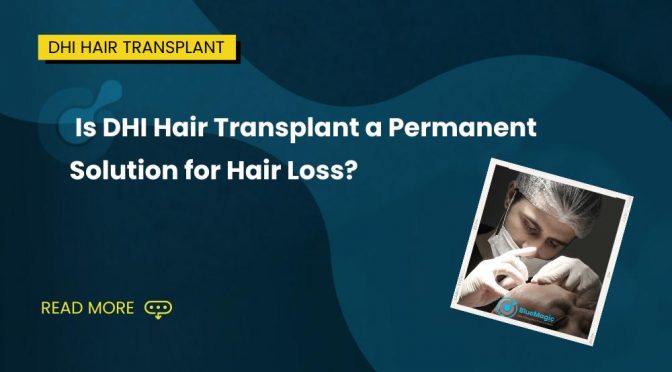 Is DHI Hair Transplant a Permanent Solution for Hair Loss?