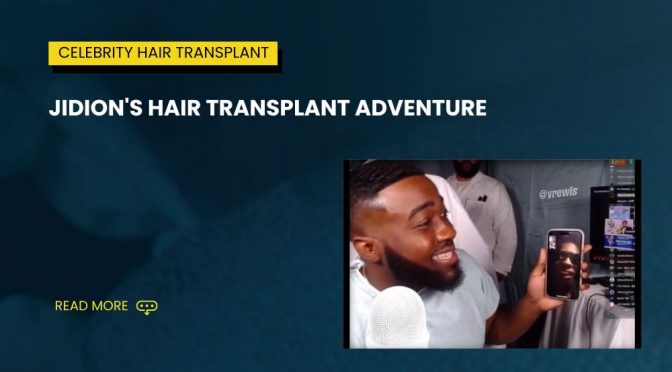 Jidions Hair Transplant Adventure