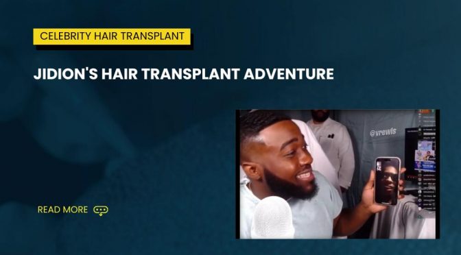 Jidion Hair Transplant Adventure