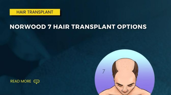 Norwood 7 Hair Transplant Options