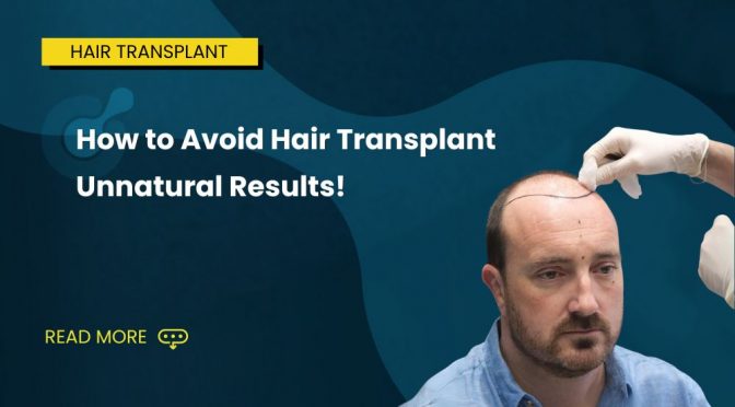 How to Avoid Hair Transplant Unnatural Results
