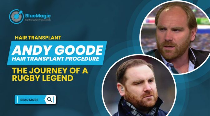 Andy Goode: The Journey of a Rugby Legend and Hair Transplant Success Story