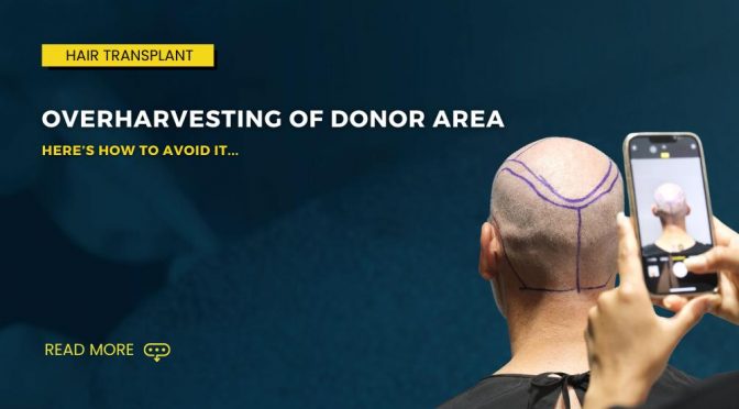 Overharvesting of Donor Area 