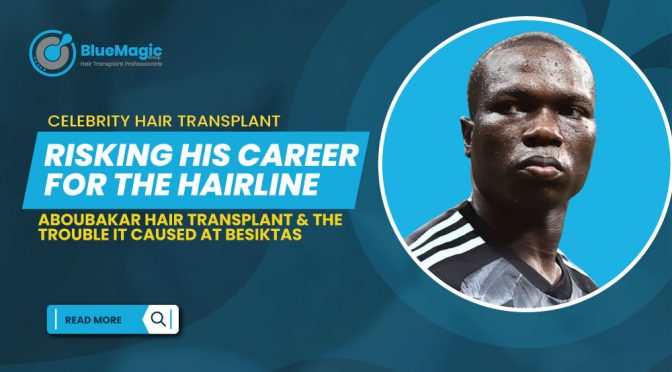 Risking His Career For The Hairline: Aboubakar Hair Transplant & The Trouble it Caused at Besiktas