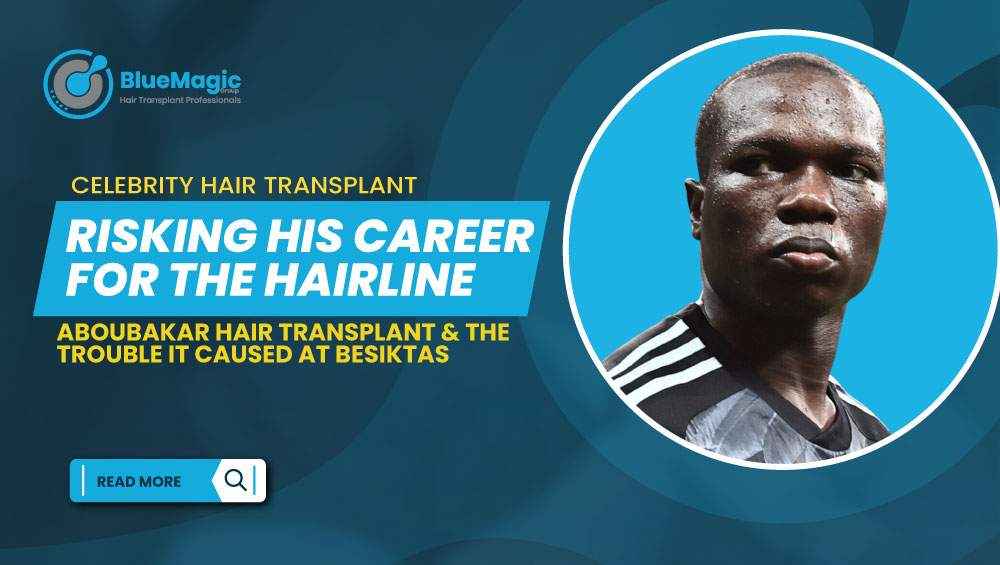 Aboubakar Hair Transplant The Trouble it Caused at Besiktas