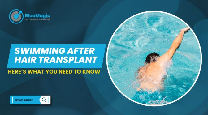 Swimming after hair transplant: Here’s what you need to know