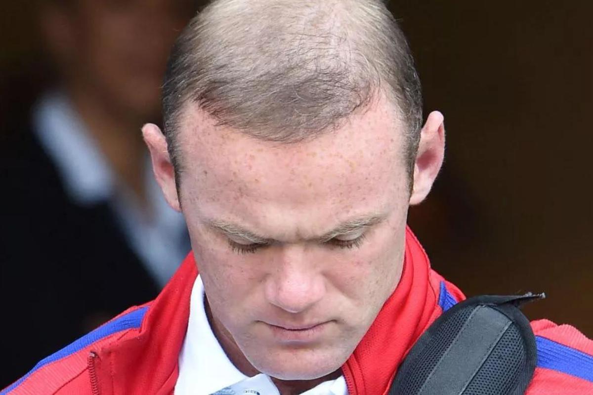 Wanee Rooney's image of the top of his head in 2016 where you can see his hair fall situation