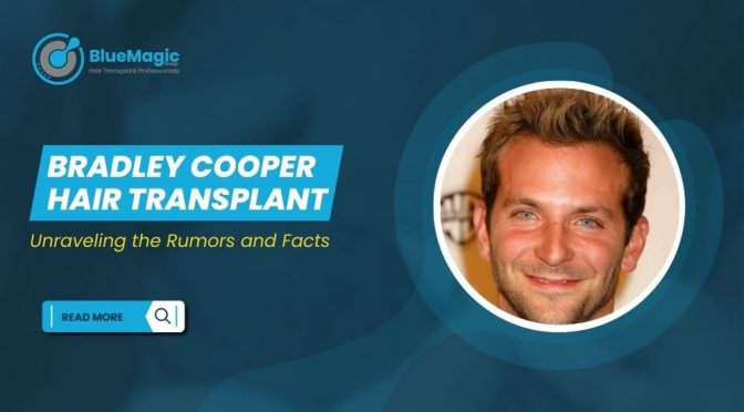 Bradley Cooper Hair Transplant 1