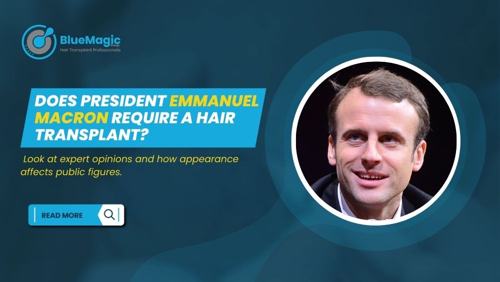 Does President Emmanuel Macron require a hair transplant