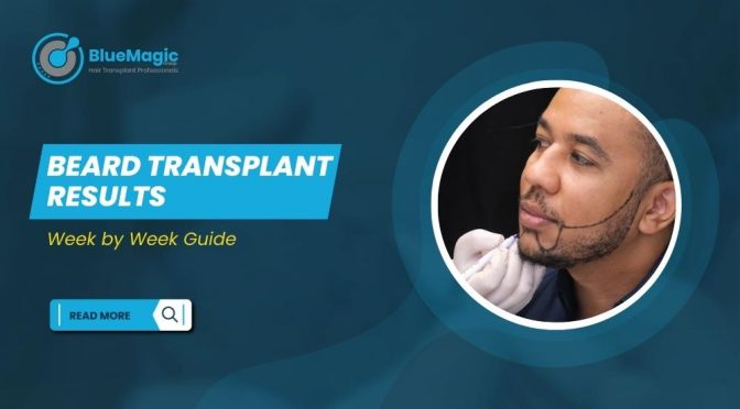 Beard Transplant Results Week by week guide