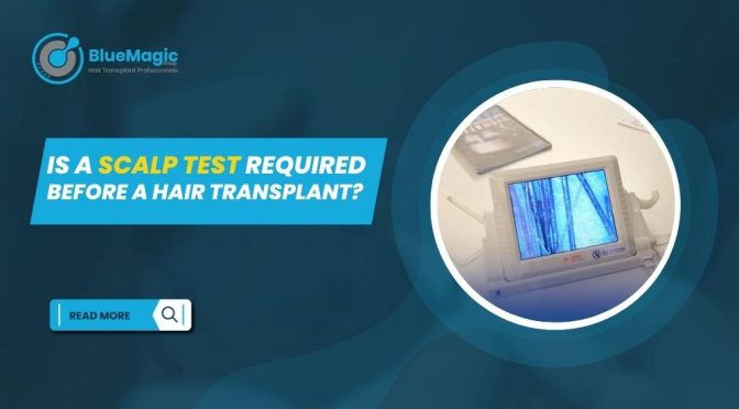 Is a Scalp Test Required Before a Hair Transplant