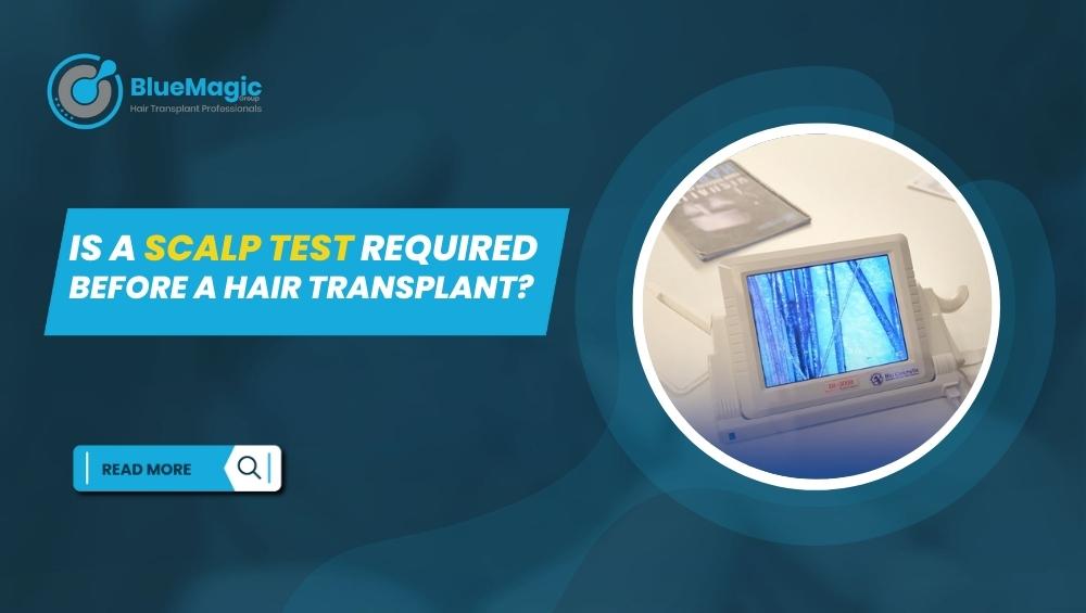 Is a Scalp Test Required Before a Hair Transplant