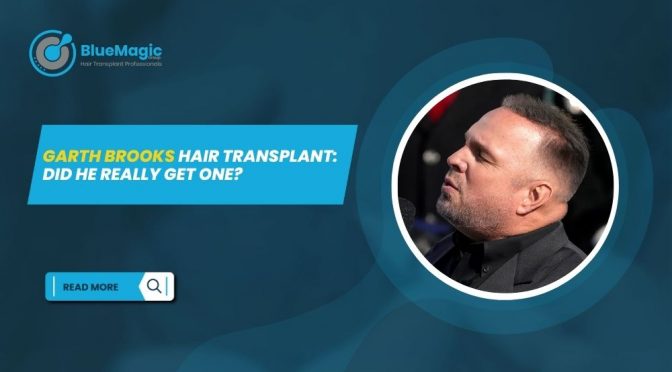 Garth Brooks Hair Transplant Did He Really Get One