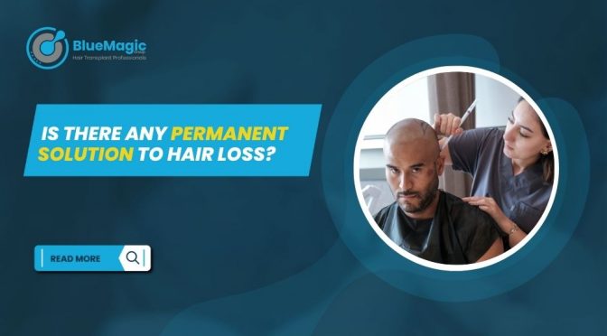 Is There Any Permanent Solution to Hair Loss 672x372 1